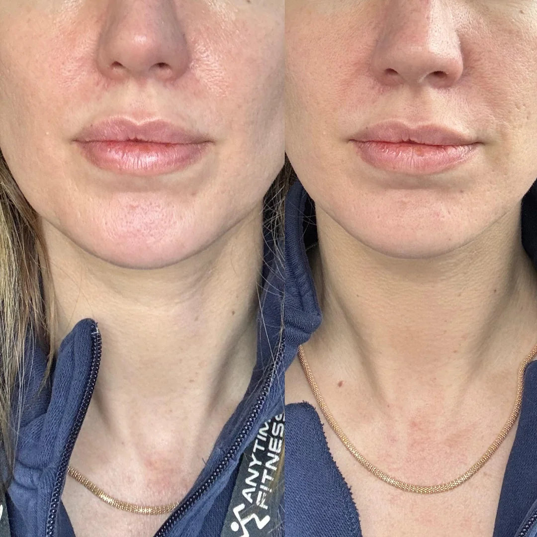 Lymphatic Contour Face Brush (Buy 1 Get 1 Free)